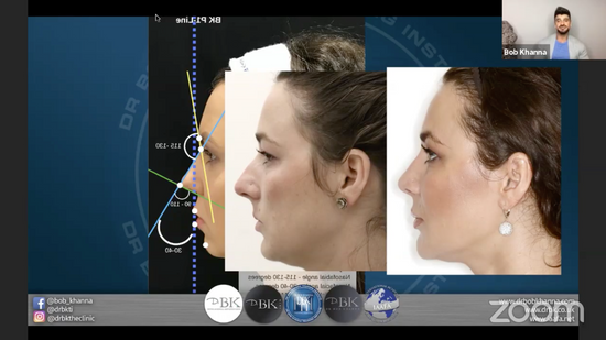 Facial Aesthetics SOS / Episode 3: Mastering The Midface